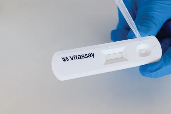 Influenza A + B photo 1